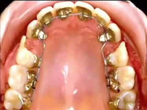 Vï¿½deos de 