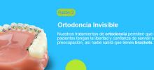 Sonríe sin que nadie sepa que tienes brackets