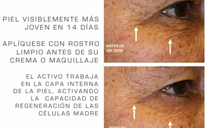 ActiveCell Elyne piel visiblemente más joven 14 días